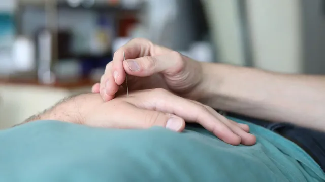 Praticien insérant une aiguille d'acupuncture dans la main d'un patient, cabinet de consultation