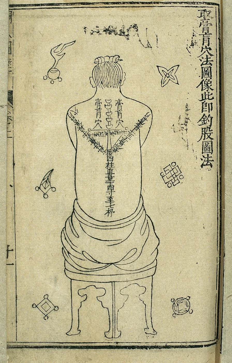 Localisation du point gaohuang, planche du manuel d’acupuncture de Wang Weiyi (1443)